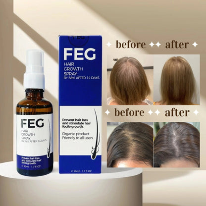 Rootroxy™ FEG plus Hair Growth Spray